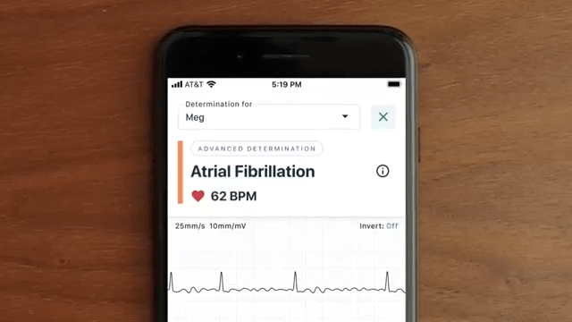 Rabatt CHECK, aktuelle Angebote des Tages. Entdecken Sie die neuesten EKG Geräte für präzise Herzdiagnosen – Jetzt mit attraktiven Angeboten des Tages!